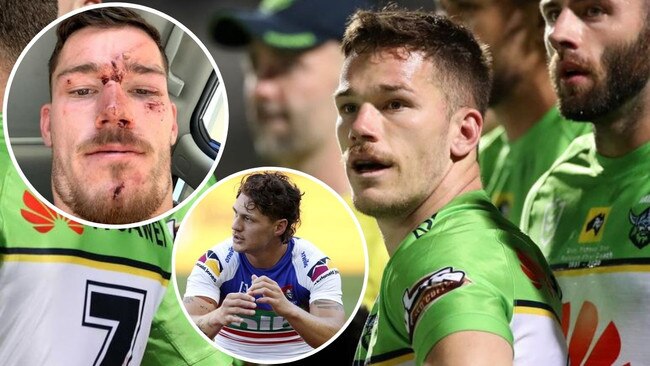 Starling arrest: Ponga among NRL stars caught in crossfire