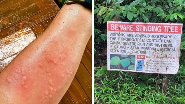 Aussie campers are being urged to steer clear of a deceptively ordinary-looking plant in the bush, after one man shared his  experience of a sting that he says was “worse than a snake bite”.