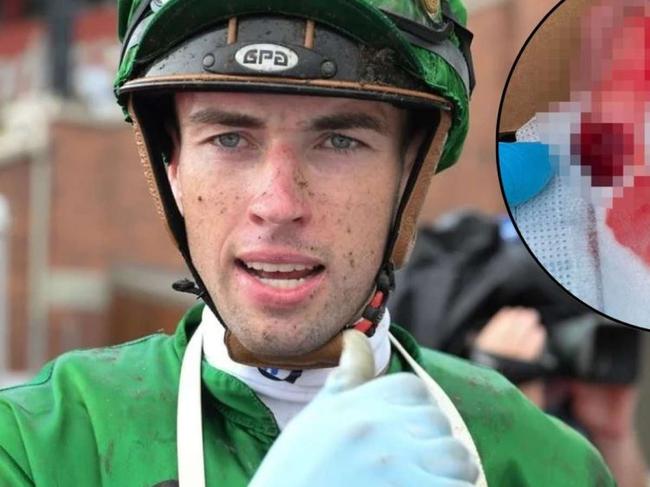 James Orman had the tip of his finger bitten off by a horse on Tuesday morning. Picture: Grant Peters/Trackside Photography.