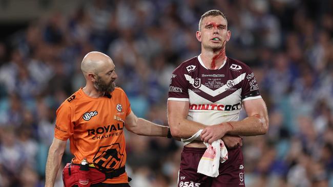 SYDNEY, AUSTRALIA - AUGUST 30:  Tom Trbojevic of the Sea Eagles is assisted by a trainer after an injury and a head cut during the round 26 NRL match between Canterbury Bulldogs and Manly Sea Eagles at Accor Stadium on August 30, 2024, in Sydney, Australia. (Photo by Cameron Spencer/Getty Images)