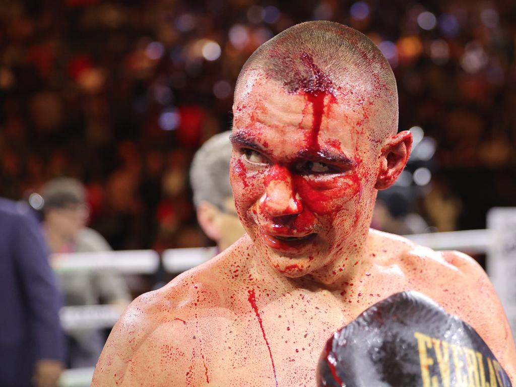 LAS VEGAS, NEVADA - MARCH 30: WBO junior middleweight champion Tim Tszyu (L) walks to his corner after a 12-round fight against Sebastian Fundora at T-Mobile Arena on March 30, 2024 in Las Vegas, Nevada. Fundora won Tszyu's title and a vacant WBC title by split decision. (Photo by Steve Marcus/Getty Images)