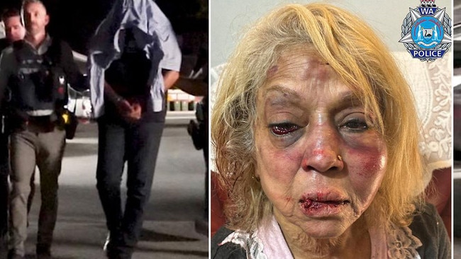 Ninette Simons received severe facial bruising and swelling after she was assaulted during a shocking home invasion. Detectives in Perth have charged two men and a woman. Pictures: WA Police