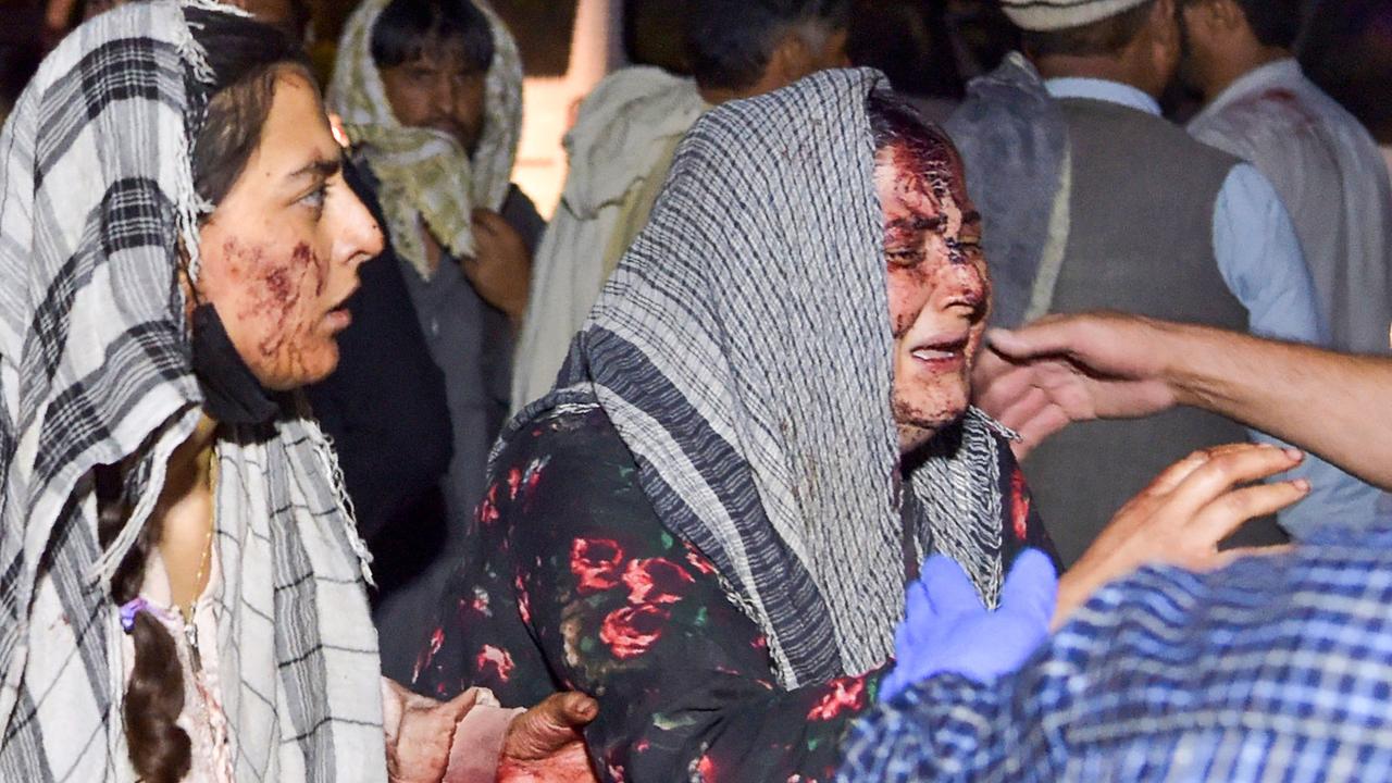 Wounded women arrive at a hospital for treatment. Picture: Wakil Kohsar/AFP