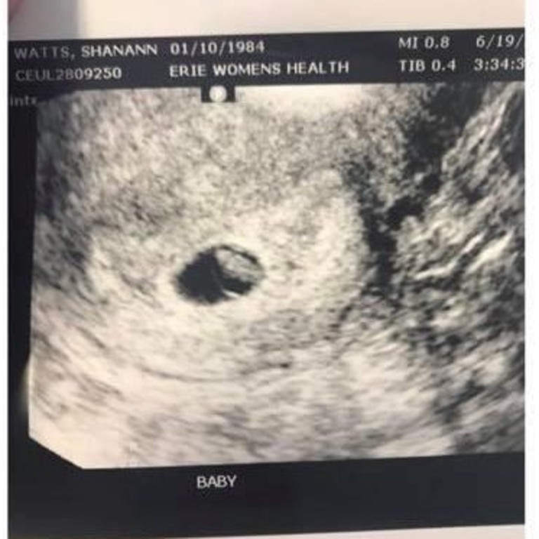 An image of Shanann Watts’ ultrasound of the baby she was carrying when she was murdered.