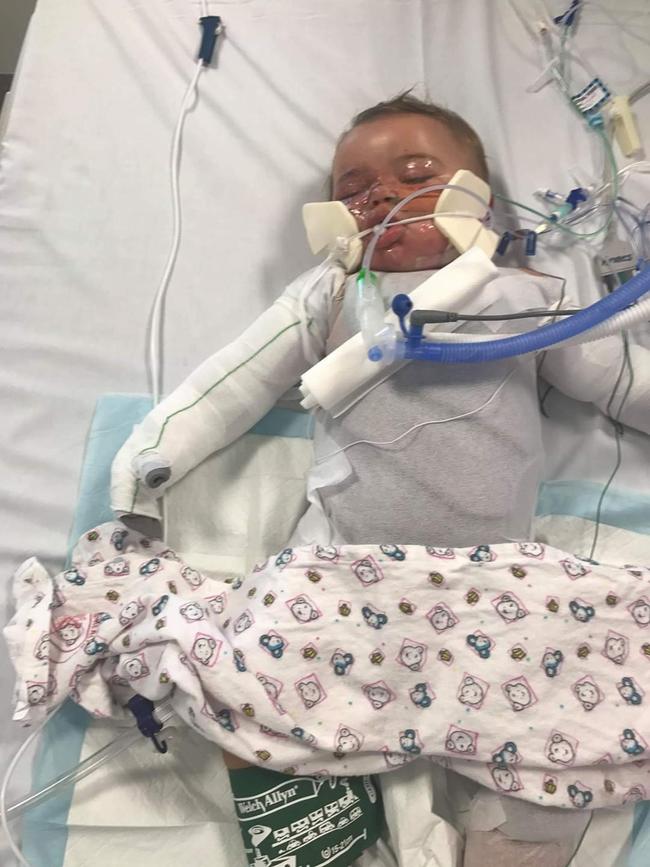 Braylen Macnamara spent 16 days in the paediatric intensive care unit.