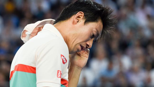 It was a painful finish for Nishikori. (Photo by Greg Wood / AFP)