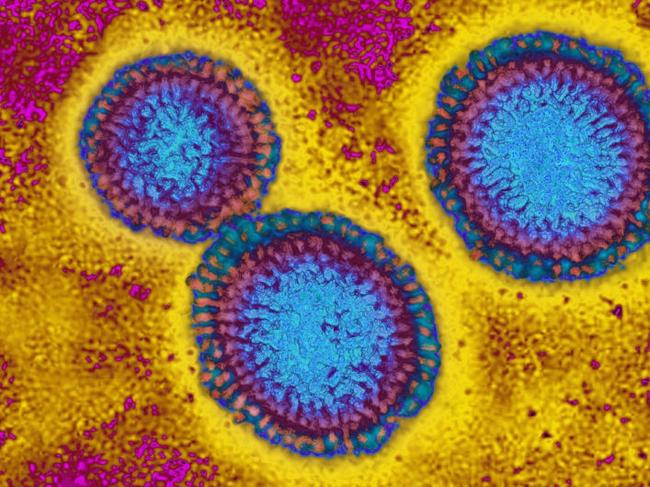 Influenza virus. Image produced from an image taken with transmission electron microscopy. Viral diameter ranges from around 80 to 120 nm. (Photo by: BSIP/UIG via Getty Images)