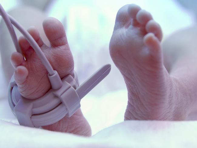 Feet of new born baby under ultraviolet lamp in the incubator. iStock Image - Generic