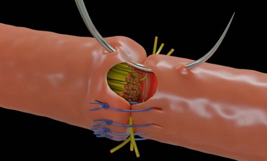 Cel gro images showing how the it promotes nerve growth.