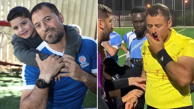 Referee Khoder Yaghi with one of his sons, Mikaeel, 4, at home in western Sydney on Wednesday, left.Khoder is recovering after he was allegedly assaulted and had his jaw broken, right, while refereeing a soccer game at Greenacre on April 28. Pictures: John Grainger/Supplied