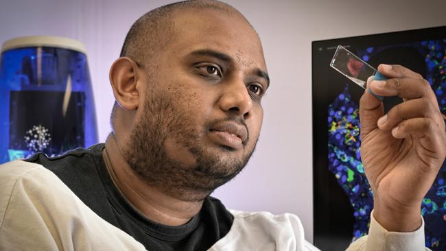 Arutha Kulasinghe holding the samples of lung tissue. Picture: Lyndon Mechielsen