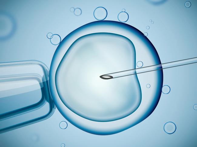 IVF treatments will now cost up to $1000 each round under a new lost-cost model. Picture: iStock