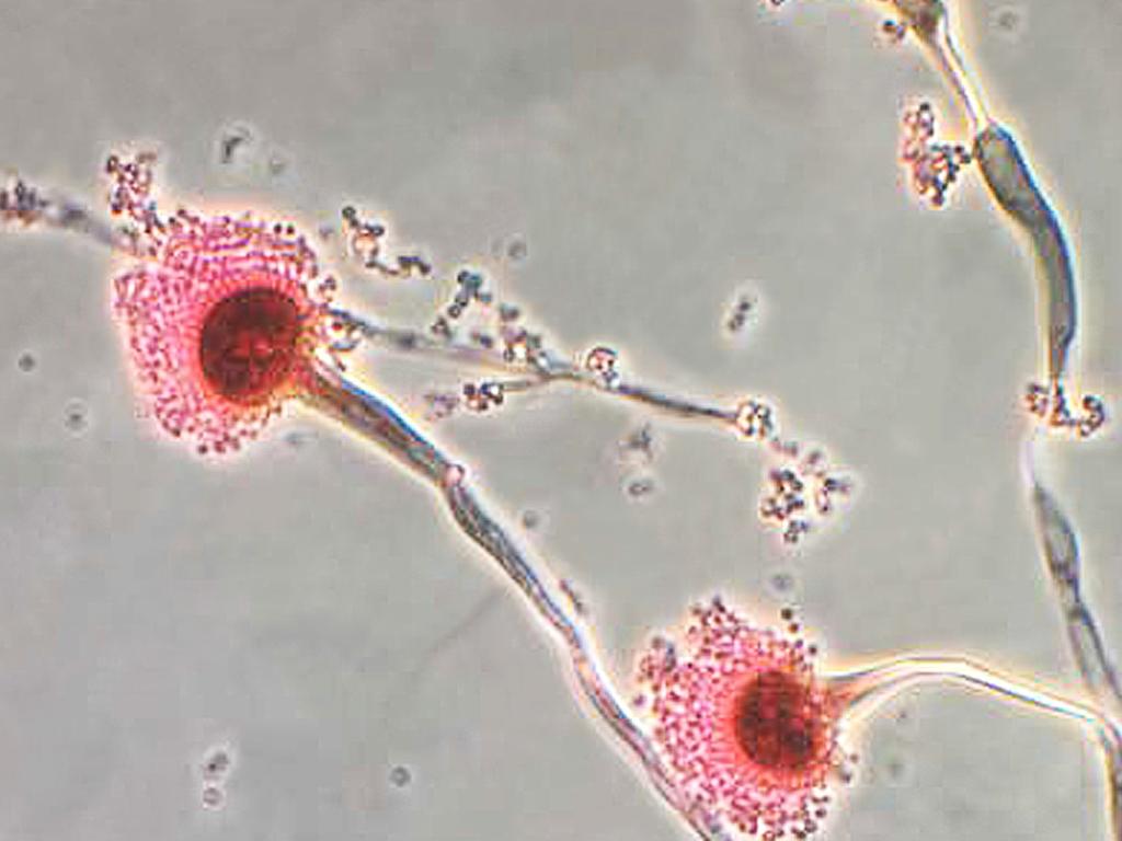 The fungi Aspergillus. Picture: CDC