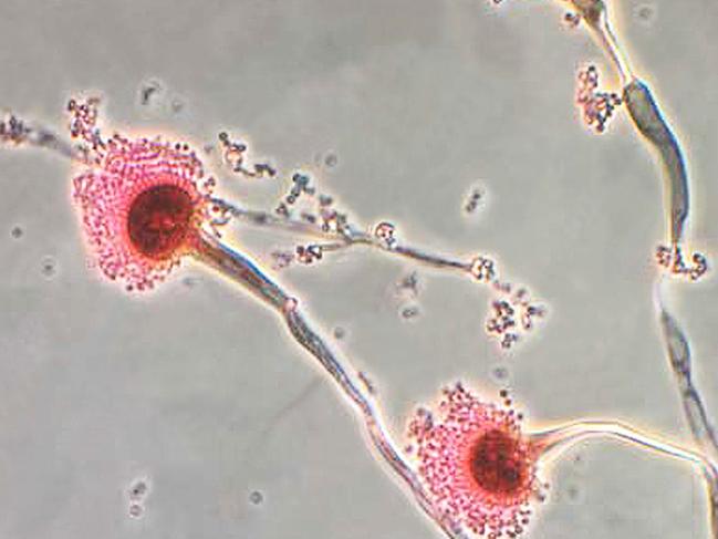 The fungi Aspergillus. Picture: CDC