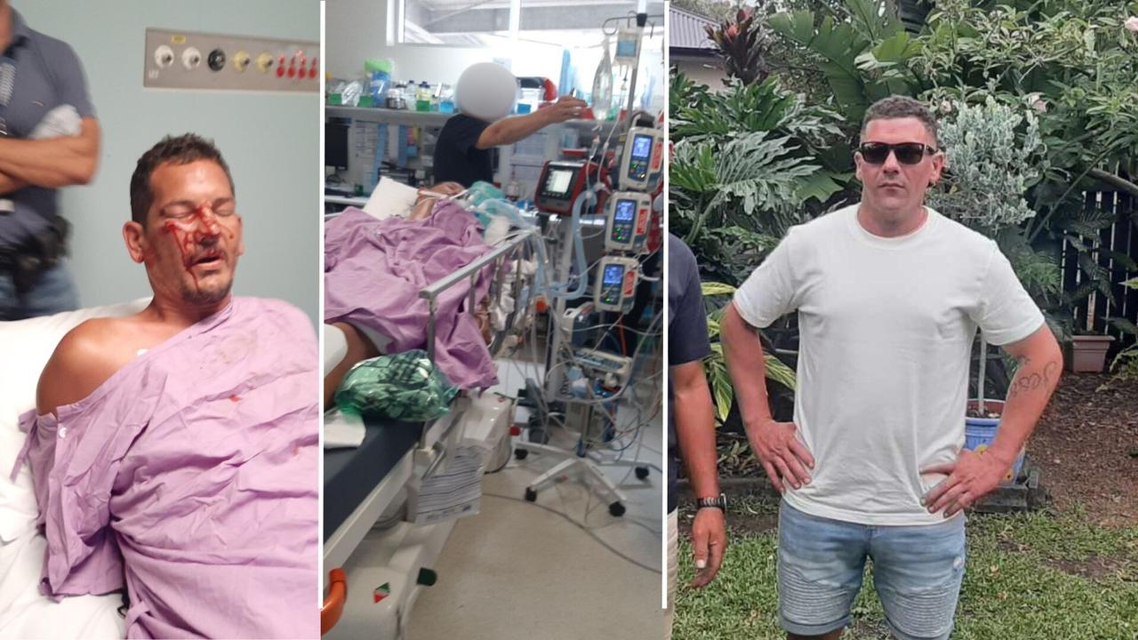 Josh Healy was allowed to walk out of Bundaberg Hospital soon after being brought out of a medically induced coma. He was brought back to the hospital later that day in police custody with a fractured eye socket.