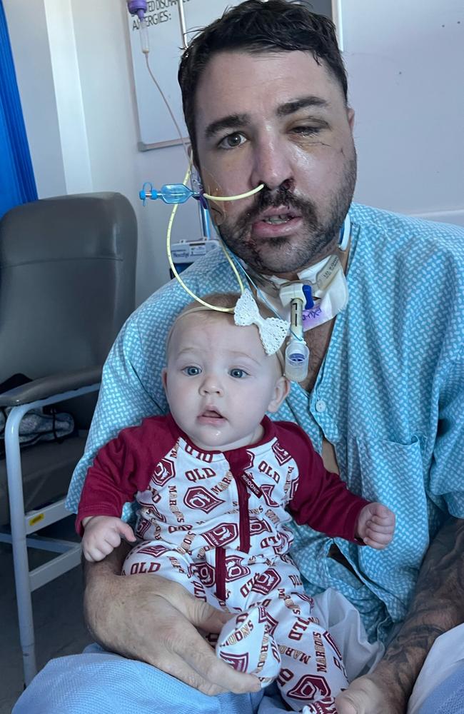 Shannon Pacher with his daughter Ellie at Townsville University Hospital after the head-on collision at Hay Point on June 5. Picture: Contributed