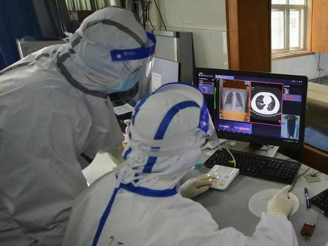 Medical staff make CT scan for a patient infected by the COVID-19 coronavirus at Red Cross Hospital in Wuhan in China's central Hubei province on March 11, 2020. - China announced on March 11 that key companies will be allowed to resume work in coronavirus-hit Wuhan, in another sign authorities are confident the quarantined city is winning its battle against the epidemic. (Photo by STR / AFP) / China OUT