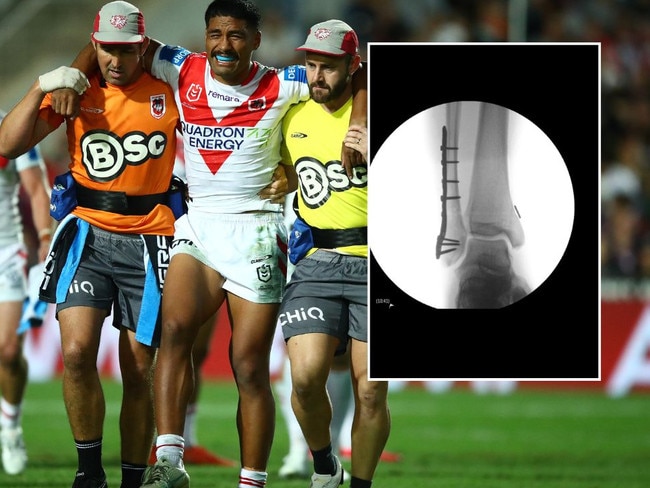 Mat Feagai suffered a terrible injury from a hip drop.