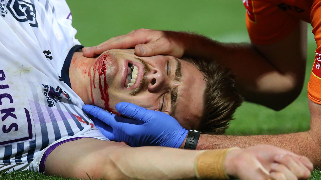 Ryan Papenhuyzen of the Storm lies on the field injured during the NRL Preliminary Final match between the Sydney Roosters and the Melbourne Storm