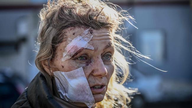 A wounded woman stands outside a hospital after the bombing of the eastern Ukraine town of Chuguiv. Picture: Aris Messinis / AFP