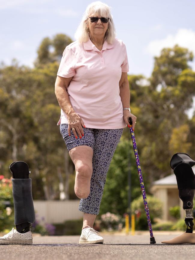 Vivienne Duffett has had her right leg amputated below the knee after being hit on her motorbike by a drugged driver on a country road in 2014. Picture: Kelly Barnes