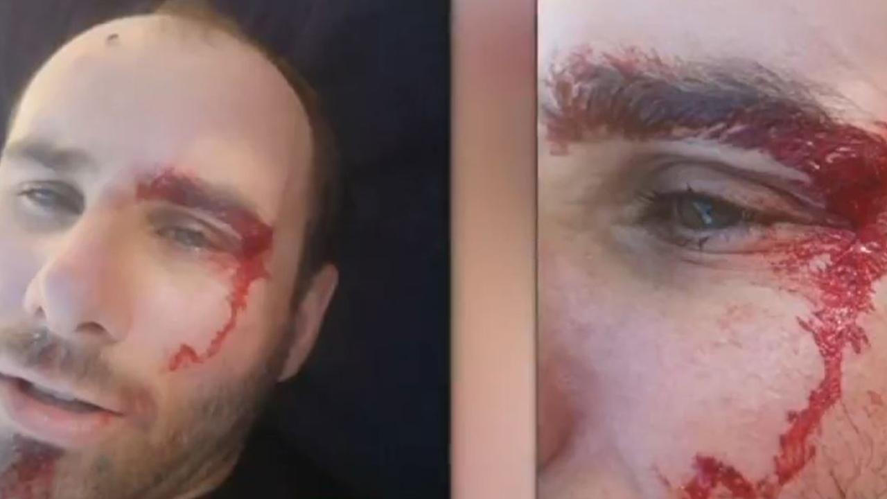 A Broome man was attacked by a crocodile in a remote region of WA .