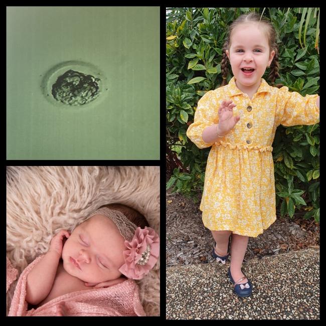 Townsville miracle babies - We are grateful for Dr Chang for blessing us with our beautiful daughter Frankie Bella via IVF in 2018. Photo: Mel Britton