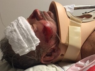 Fred May in hospital after being hit by a car