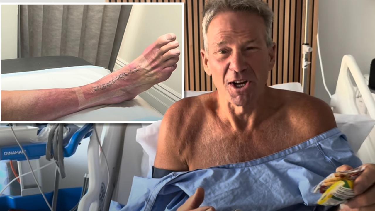 ‘Not many alternatives left’: Sam Newman considers drastic fix for pain ravaged ankle