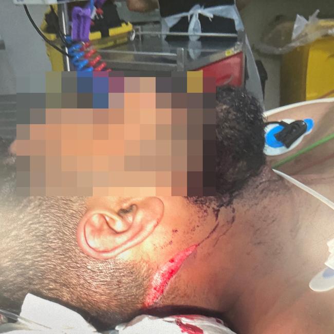 Picture of brawl victim's injuries tendered to court.