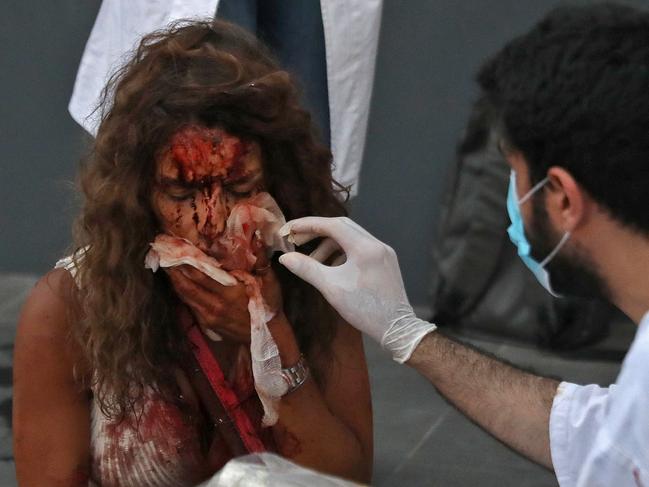 A medic tends to the injuries of a woman outside a hospital following an explosion in Beirut. Picture: AFP