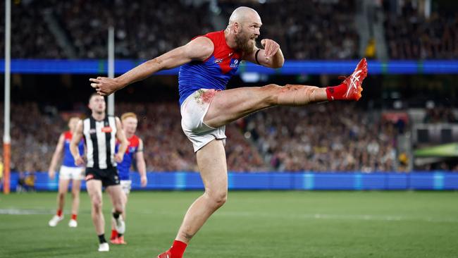 A rumoured injury won’t stop Max Gawn from playing. Picture: Michael Willson/AFL Photos via Getty Images