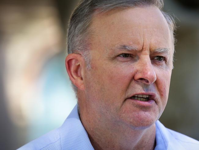 SYDNEY, AUSTRALIA - JANUARY 09, 2021: Anthony Albanese Leader of the Opposition and Leader of the Labor Party is seen leaving the RPA Hospital today after a car accident yesterday in Marrickville in Sydney, Australia. Picture: Newscorp - Sunday Telegraph / Gaye Gerard