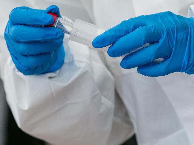 WEISSENFELS, GERMANY - MAY 14: An employee of the district 'Burgenlandkreis', holds a test kit at the test station for possible Covid-19 infections for the workers of the Toennies slaughterhouse and meat processing plant on May 14, 2020 in WeiÃŸenfels, Germany. Meat processing plants across Germany are conducting Covid-19 testing of employees nationwide following an outbreak of several hundred infections at a plant in western Germany recently. Many of the plants employ workers from eastern Europe who live in close quarters in dormitories and are hence at a higher risk of infection. (Photo by Jens Schlueter/Getty Images)