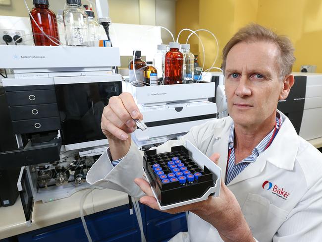 Professor Peter Meikle of the Baker Heart and Diabetes Institute. Picture: Ian Currie