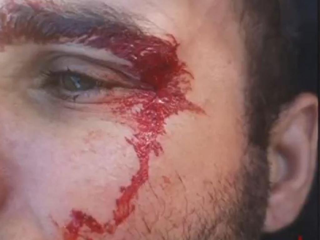 The man said the attack was the ‘scariest he’s experienced in his entire life’.