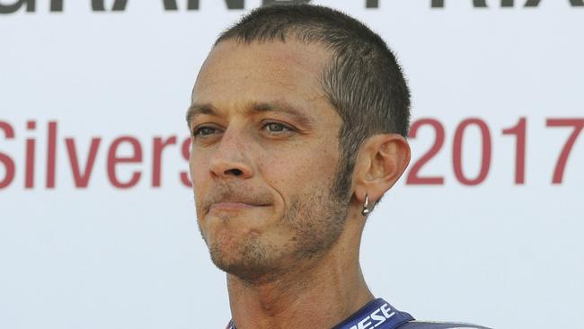 FILE - In this Aug. 27, 2017 file photo, Italy's Valentino Rossi of Movistar Yamaha looks on after finishing third in the Moto GP race at the British Grand Prix at Silverstone, England. Six-time MotoGP champion Rossi has reportedly broken his right leg in a training accident in Italy. According to Italian sports daily Gazzetta dello Sport, Rossi fell during enduro training and fractured his tibia and fibula. (AP Photo/Rui Vieira)