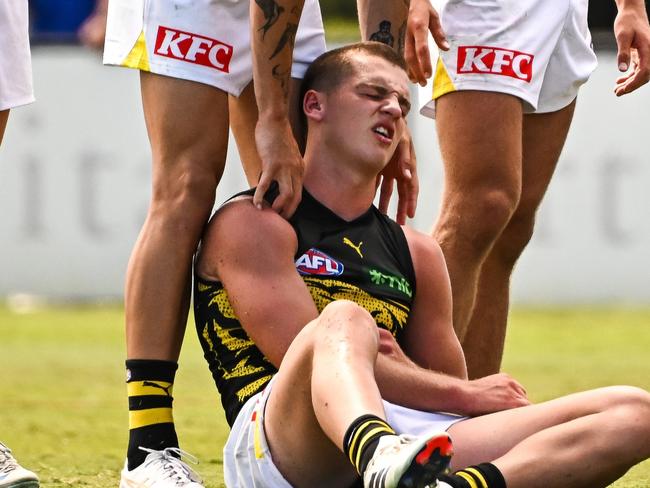 PERTH, AUSTRALIA - FEBRUARY 17: Sam Lalor of the Tigers lays injured during the 2025 AFL Match Simulation between the West Coast Eagles and the Richmond Tigers at Mineral Resources Park on February 17, 2025 in Perth, Australia. (Photo by Daniel Carson/AFL Photos via Getty Images)