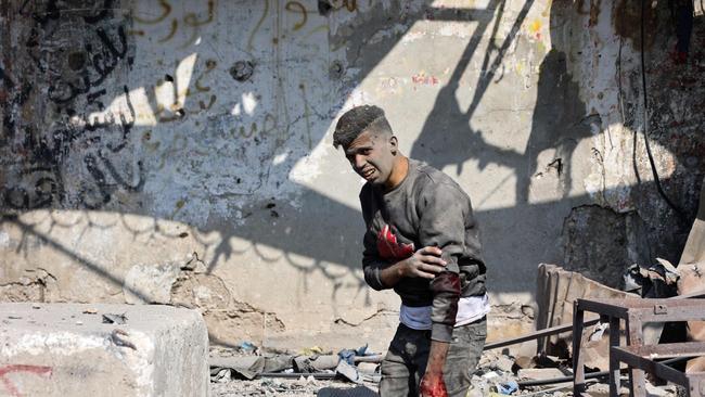 Palestinians carry an injured girl following Israeli bombardment on the Firas market area in Gaza City. Picture: AFP