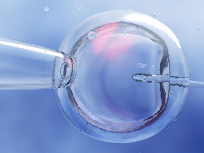 IVF (in vitro fertilization) or insemination of female egg with microscope