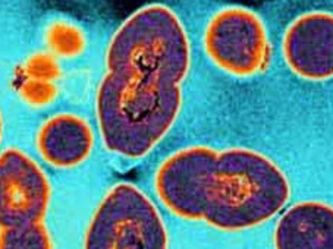Killers: Superbugs could mean common infections could once again be lethal. Picture: Supplied