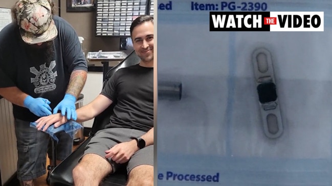 Tesla owner implants car keys in his hand