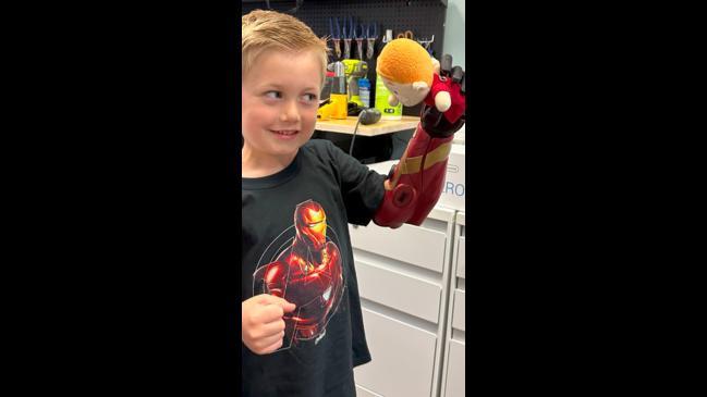 Boy becomes youngest person to receive bionic arm