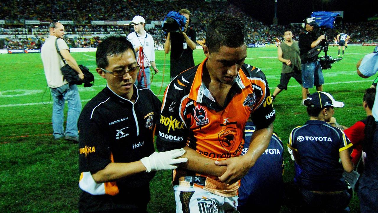 Benji Marshall had five shoulder operations before he was 24. Picture: Cameron Laird