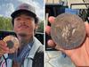 Shocking condition of medal one week later