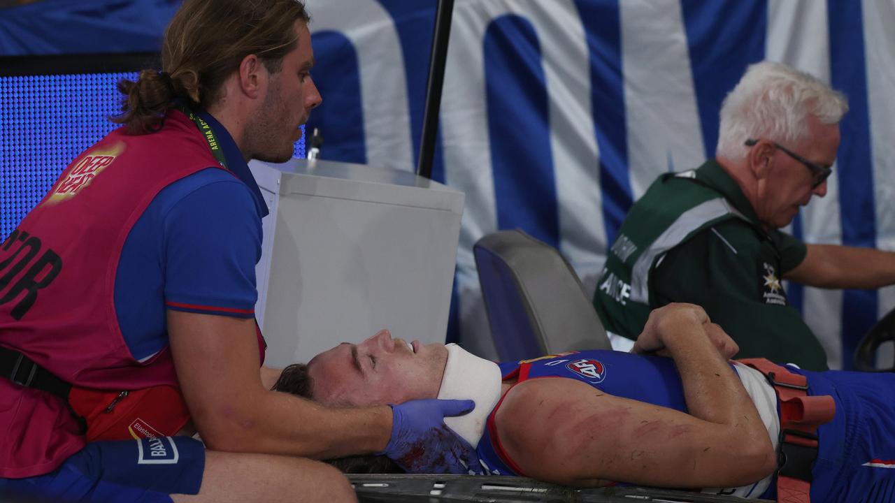 MELBOURNE, AUSTRALIA - MARCH 15: Luke Cleary of the Bulldogs is taken from the ground on a stretcher after a contest with Jackson Archer of the Kangaroos during the round one AFL match between Western Bulldogs and North Melbourne Kangaroos at Marvel Stadium, on March 15, 2025, in Melbourne, Australia. (Photo by Daniel Pockett/Getty Images)