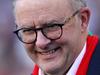 Albo’s surprise gift for King Charles