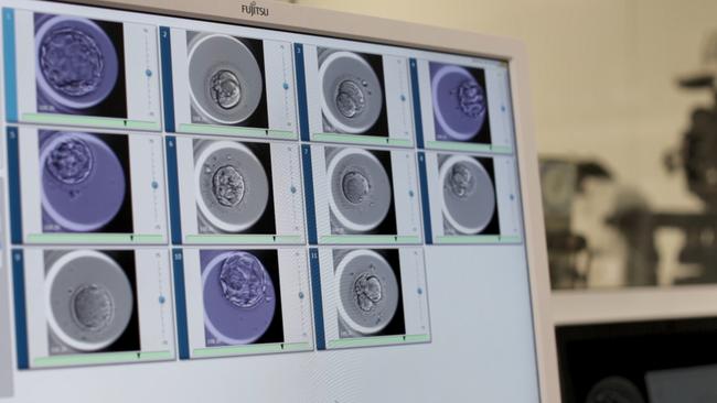 The AI helps rank and select the embryo with the highest chance of achieving successful pregnancy.