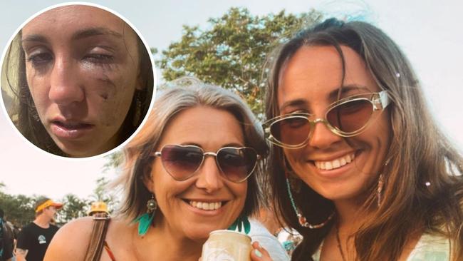 Riqui Vines and her aunty Angela Elliott were allegedly assaulted at a Rockhampton music festival.