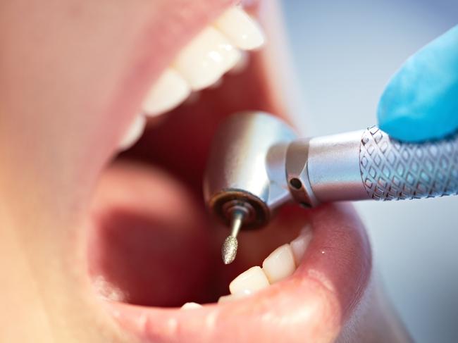 Smiles Inclusive generic dentist dental teeth. Photo: iStock